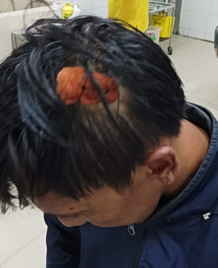Geng Motor Berulah, Dua Orang Pemuda Tanpa Dosa, Dilarikan Kerumah Sakit Akibat Dipukul Pakai Botol Miras