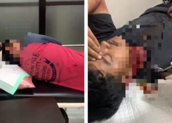 Dua Pengendara Motor Dibacok Botol di Jalan SL Tobing Tasikmalaya