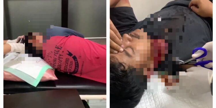 Dua Pengendara Motor Dibacok Botol di Jalan SL Tobing Tasikmalaya